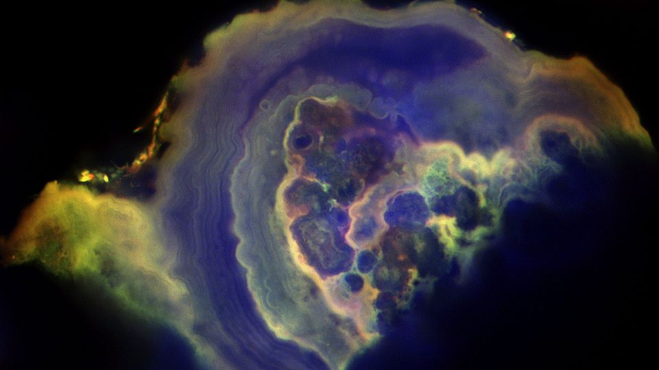 Detailed look at the geology of ductal carcinoma <i>in situ</i>