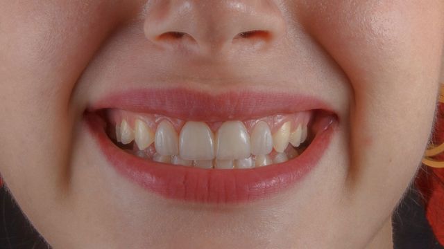 A child grins, showing their teeth. 