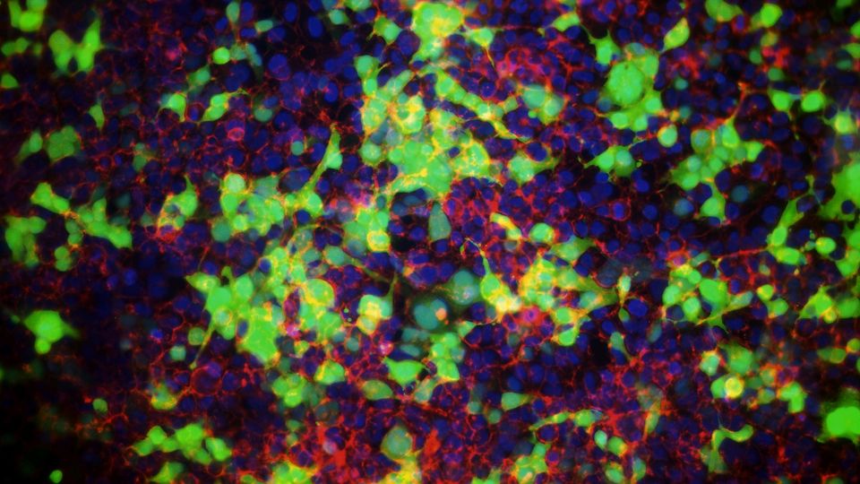 Fluorescent microscopy image showing cells transfected using GenePORTER Gold transfection reagent.