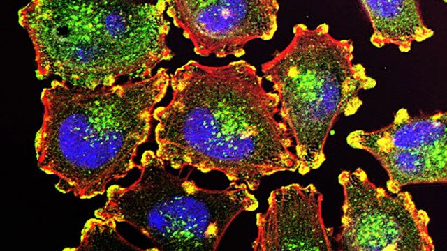 Cells with nuclei labelled in blue, cell membranes in red and proteins in yellow and green.