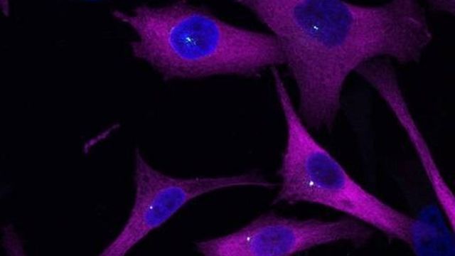 The image shows eIF2A at the centrosome (white) of cancerous cells.