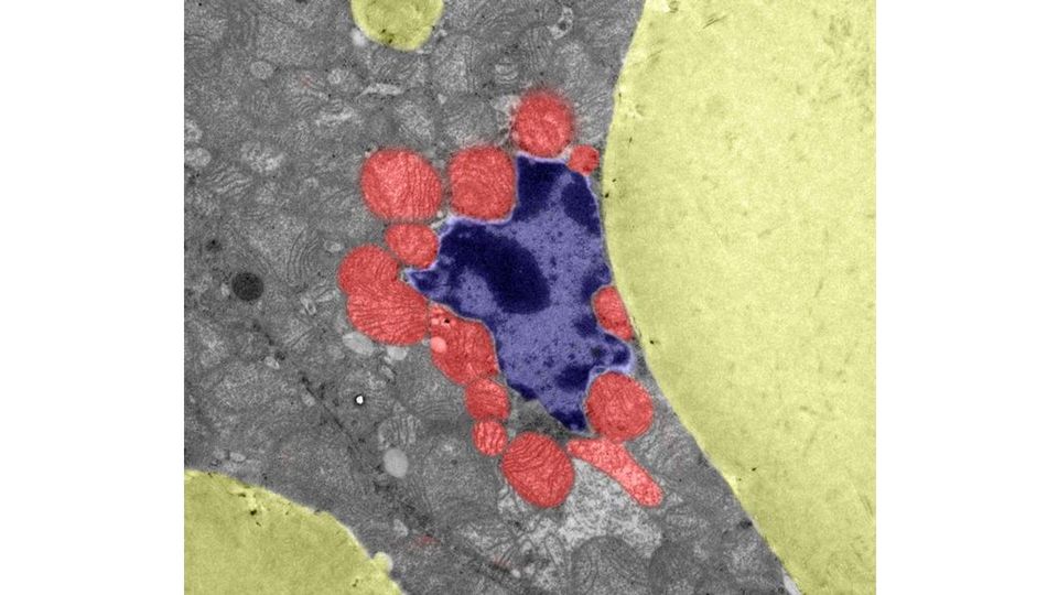 Multiple mitochondria soften and distort a cell nucleus.