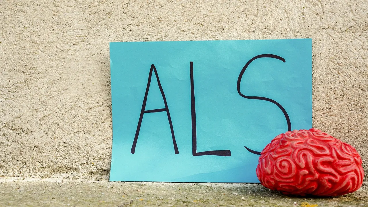 Stem Cells From ALS Patients Reveal a Potential New Target for Treatment