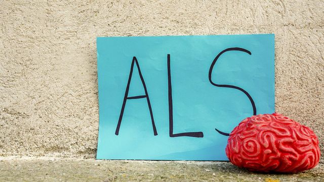 A sign with ALS written on it against a wall and next to a model of a human brain.