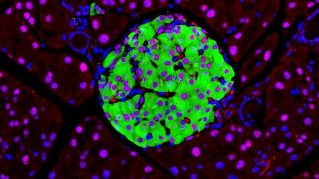 Insulin‑positive β‑cells (green) display HNF1A (red), confirming its presence across endocrine subtypes; DAPI (blue) marks nuclei.