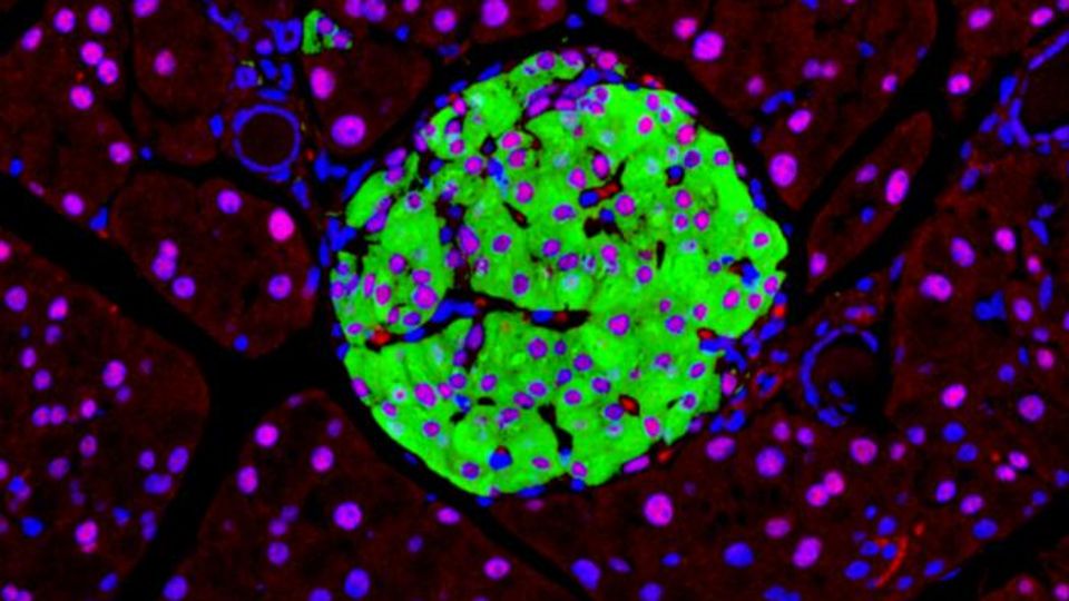Insulin‑positive β‑cells (green) display HNF1A (red), confirming its presence across endocrine subtypes; DAPI (blue) marks nuclei. 