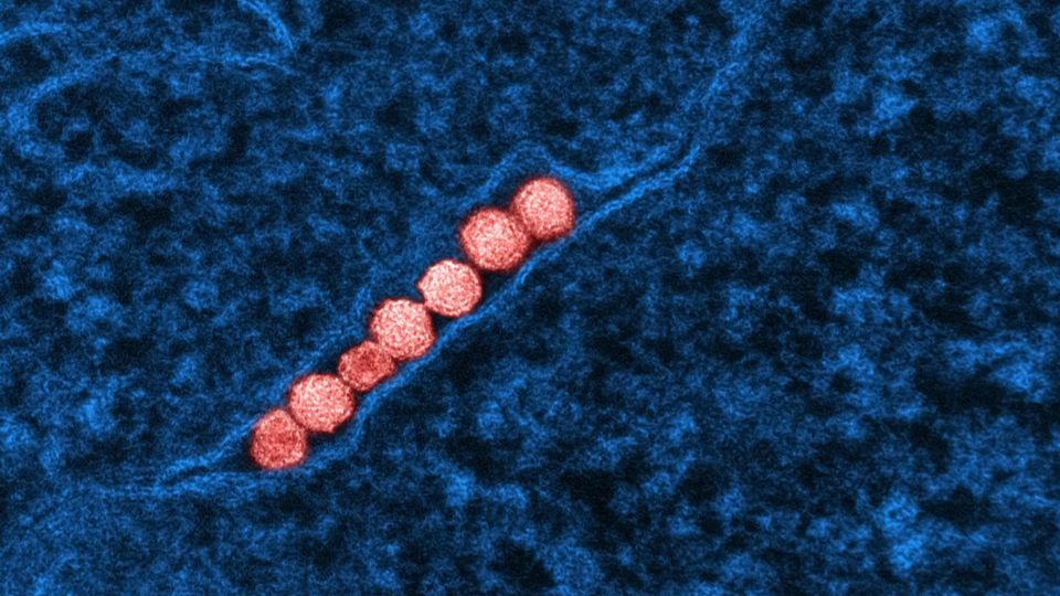 Seven West Nile Virus particles infect a human cell.