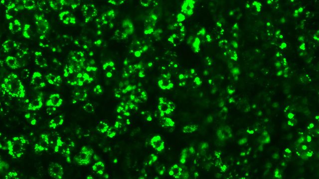 Mouse fat cells filled with lipid droplets (green). 