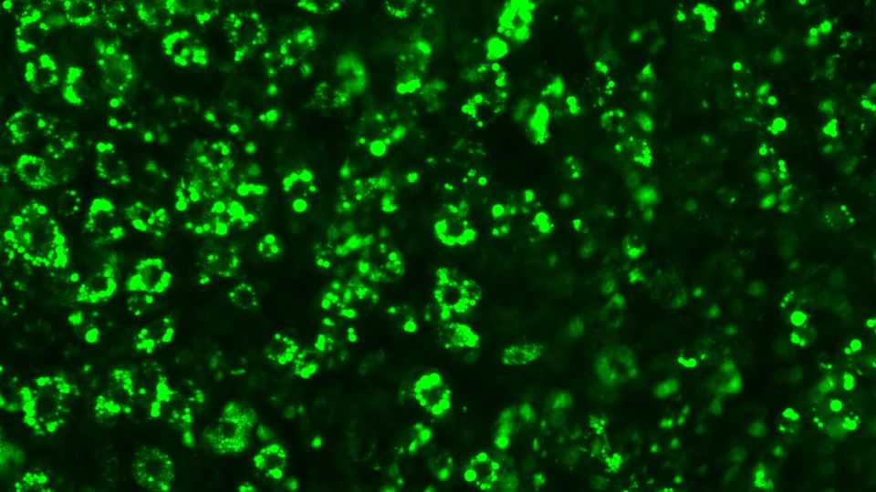 Mouse fat cells filled with lipid droplets (green).