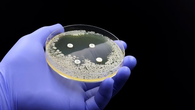 A gloved hand holding a petri dish of bacteria with four antibiotics. 