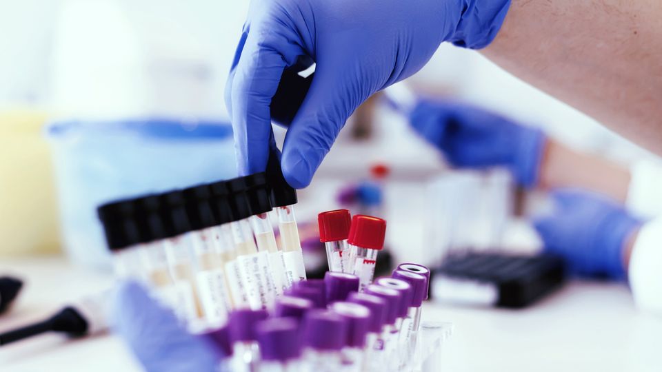 Gloved hand organizing blood sample tubes in a laboratory for biomarker analysis.