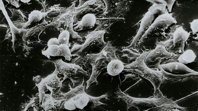 A black and white image, taken by an electron-scanning microscope, of interconnected cells/tissue. 
