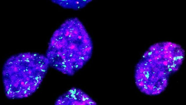 Extra-Chromosomal MYCN Fuels Neuroblastoma Relapse | Technology Networks