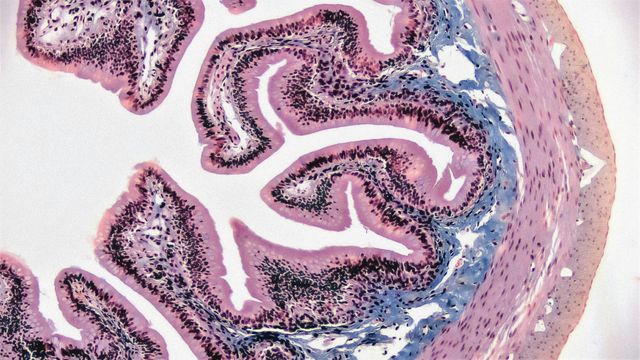 The pink and blue stain of epithelial tissue cross section under a microscope. 