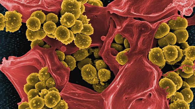 Colored electron microscope image showing clusters of yellow spherical Staphylococcus aureus bacteria among red cellular structures.