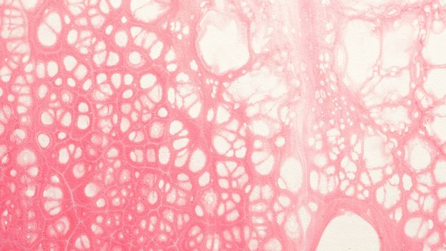 An abstract pattern symbolizing blood vessels and their formation. 