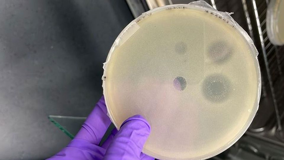 A petridish, misty with bacterial culture, with four clear circles where bacteria have been killed by antibacterials.