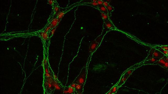 Gut Neurons Key To Controlling Inflammation in IBD