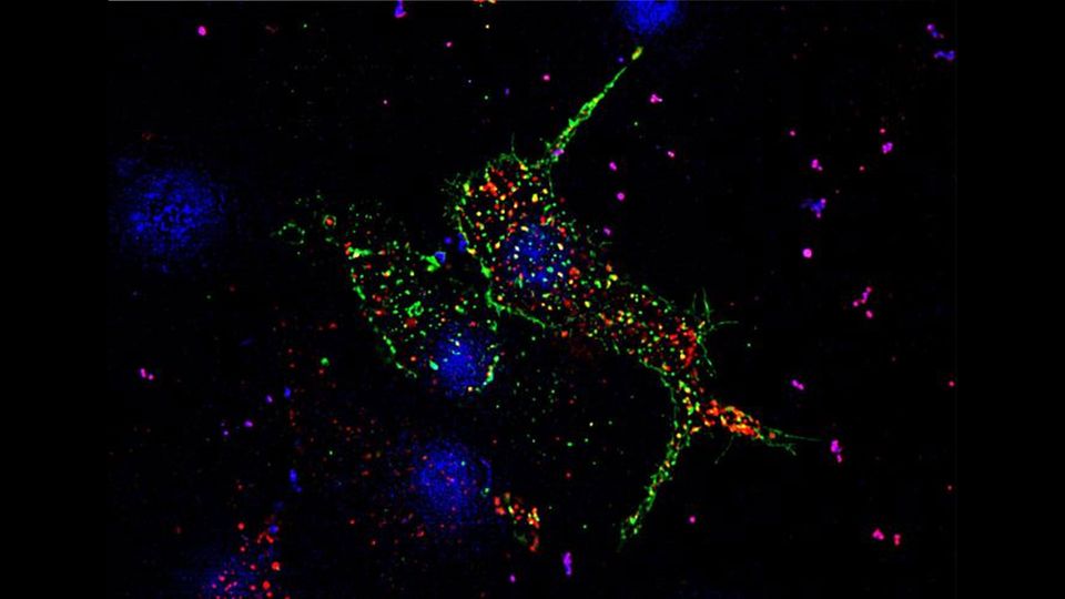 Pancreatic beta cells, with glucose transporters shown in green and insulin granules in red.