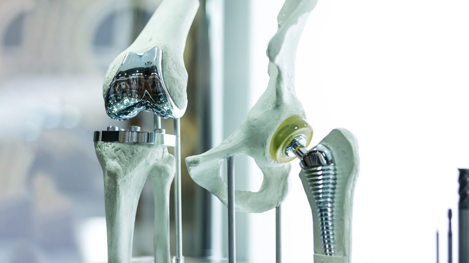 Models of human bone with biomaterial bone replacements following fractures or breaks.