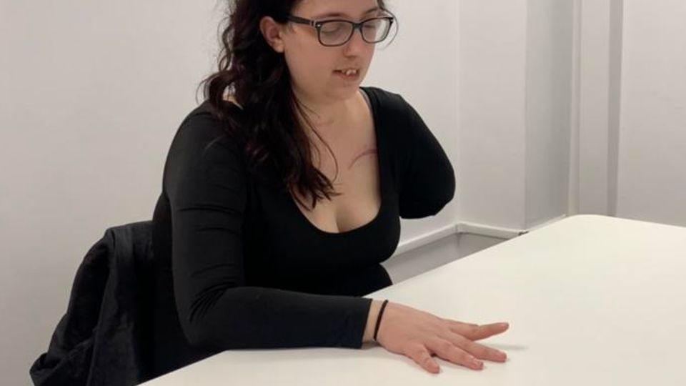 Young woman with a left arm amputation sitting at a table during a rehabilitation session.