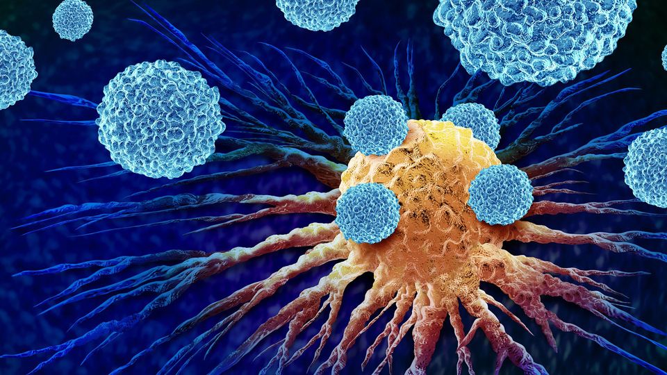 T cells in blue attacking a tumor in yellow as part of cancer immunotherapy.