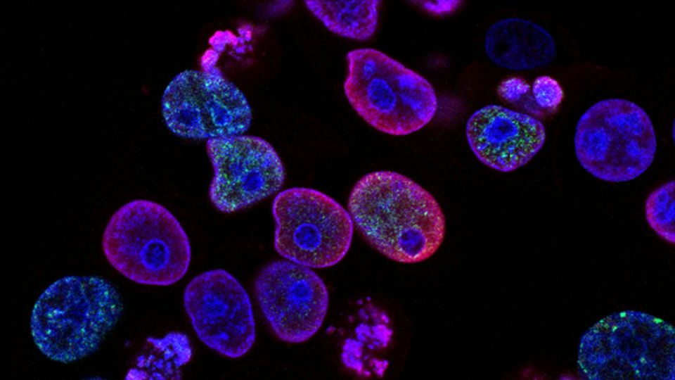 Cells with proteins labelled in pink, purple and blue.