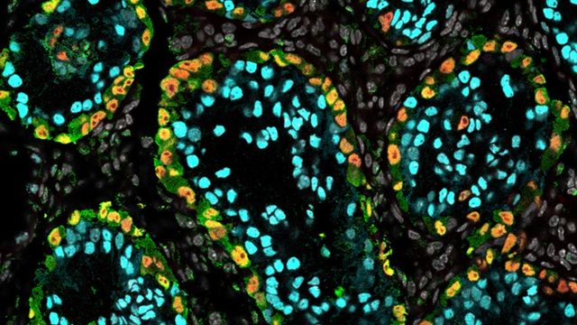 Microscopy image of xrTestes model from iPSCs supporting human spermatogonial development