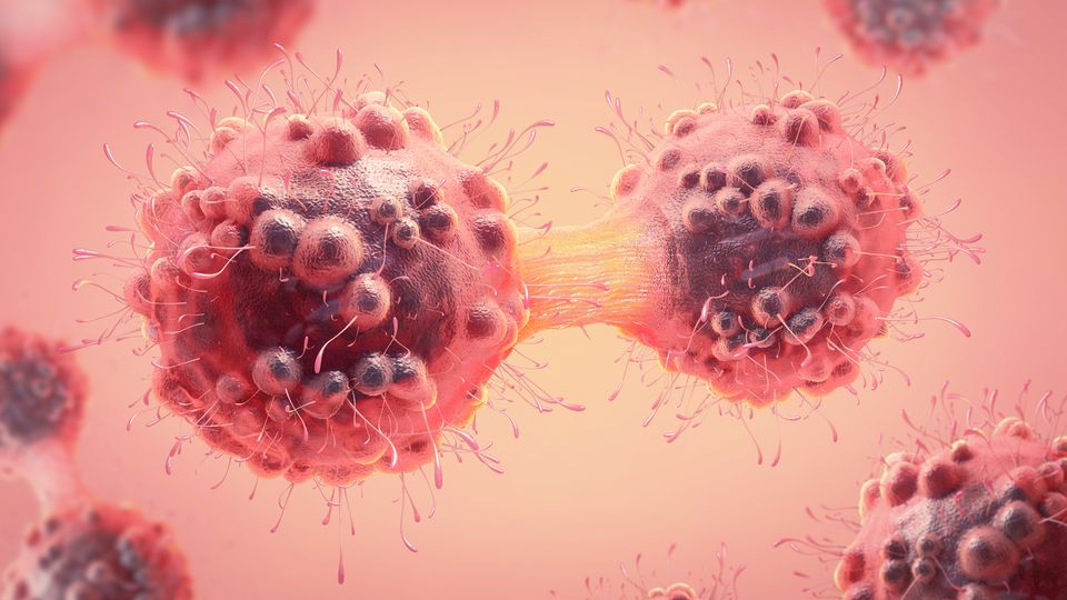 Two cancer cells deviding.