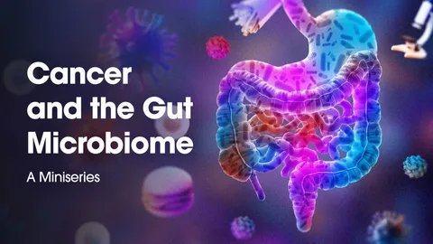 Illustration of the human gut microbiome, featuring colorful bacteria and cells, with the text "Cancer and the Gut Microbiome A Miniseries".