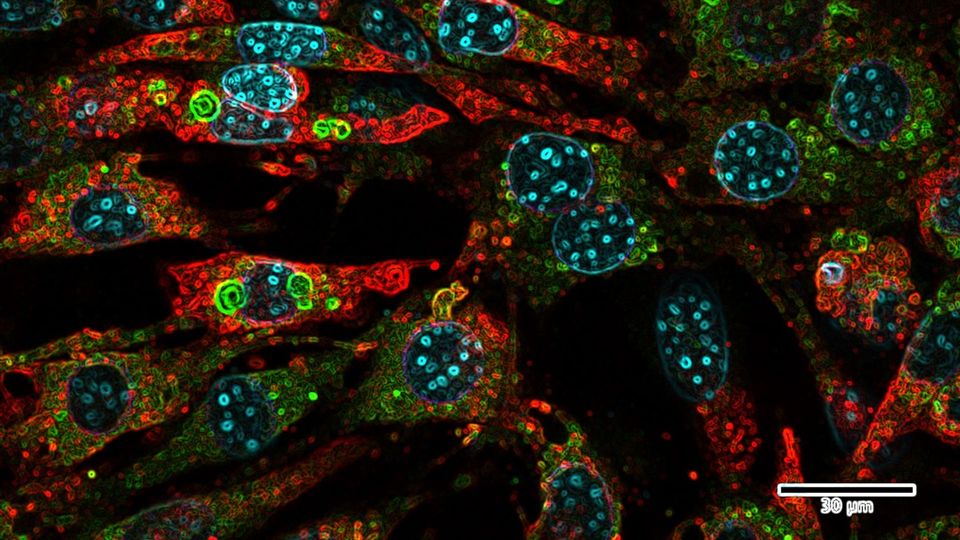 Mature brown fat cells in mice show SLC34A4-MP (red), DNA (blue), and mitochondria (green).