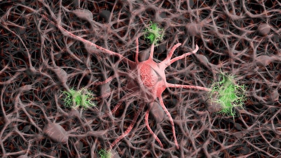 Nerve cells, with one highlighted in red and three in green, illustrating cell death in Alzheimer's.