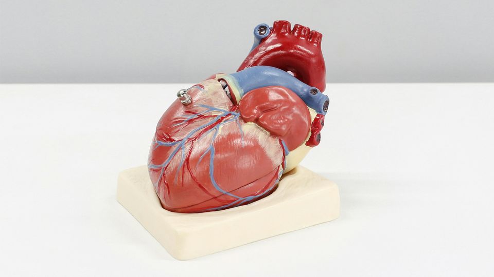 A model of a human heart on a white desk, the target of a new study looking at therapies following heart bypass surgery.