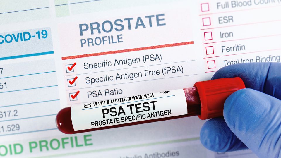 Gloved hand holding a barcoded tube of blood labeled for PSA testing with a prostate profile testing form in the background.