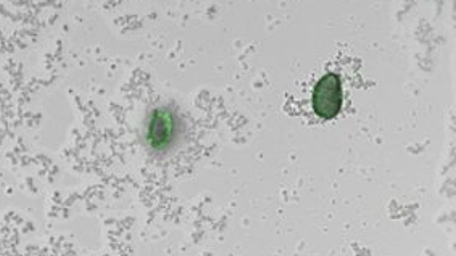 Green colored blobs (the bacteria) surrounded by small gray dots (microplastics) as viewed under a microscope