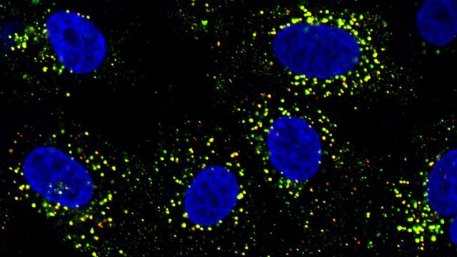 デング熱ウイルスが免疫をどのように再プログラムするか