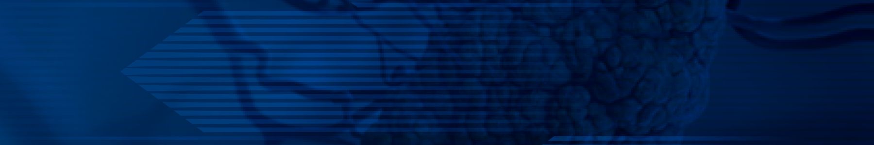 3D illustration of a tumor with branching blood vessels, used in single-cell sequencing research. 