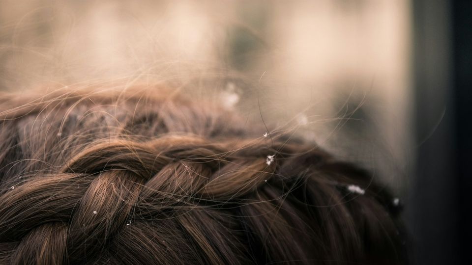 Close-up of brown braided hair with small white flakes visible, showing natural texture and detail of human hair.