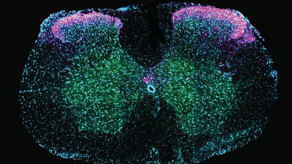 Cross-section of spinal cord showing neurons involved in ejaculation. Cells marked in pink (galanin-expressing neurons) overlap with those in green (a signal of recent activity), revealing that these neurons are active during ejaculation. Blue marks all nerve cells as a visual guide.