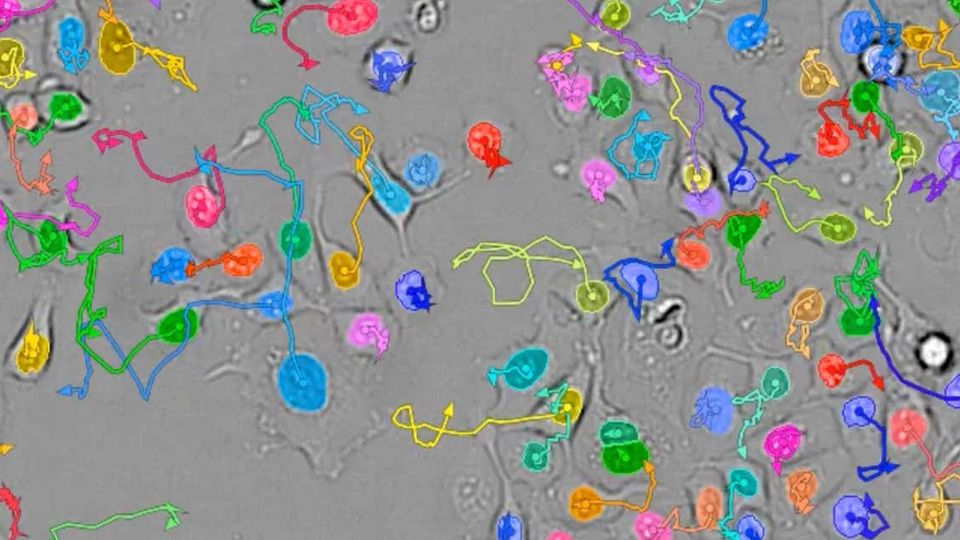 Microscopic view of a living cell under analysis with advanced live-cell imaging technology