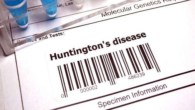 A specimen label that reads Huntington's disease above a bar code. 
