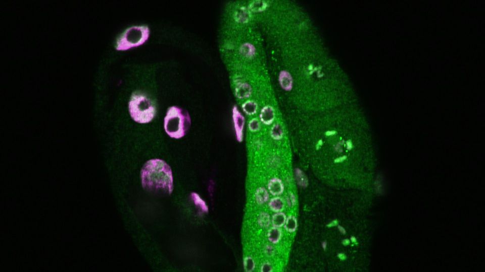 A tulip-shaped image of a worm shows the intestine on the left and the germline on the right. Green highlights histone H3 lysine 79 dimethylation, while magenta marks cell nuclei stained with DAPI.