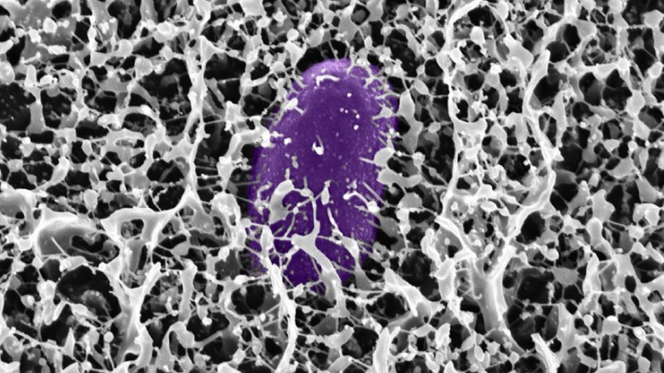 MIT researchers have discovered how mucins found in the mucus that lines the digestive tract can disarm the bacterium that causes Salmonella (purple).