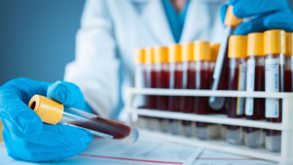 Individual with white coat and blue gloves on inspecting multiple blood samples in a tube rack.