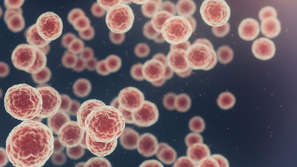Microscopic 3D illustration of multiple cancer cells spreading in the body.