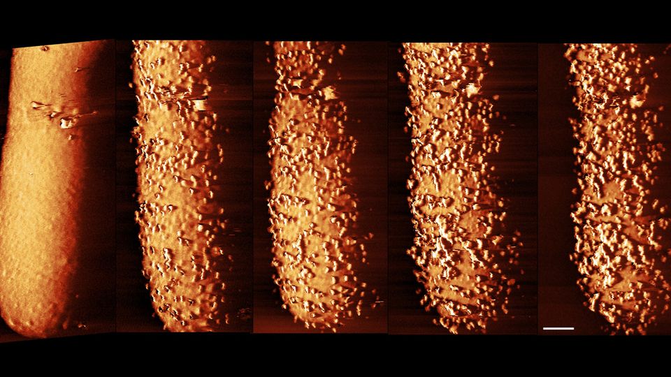 Changes to the outer layer of bacteria's armour over time when exposed to the antibiotic Polymyxin B.
