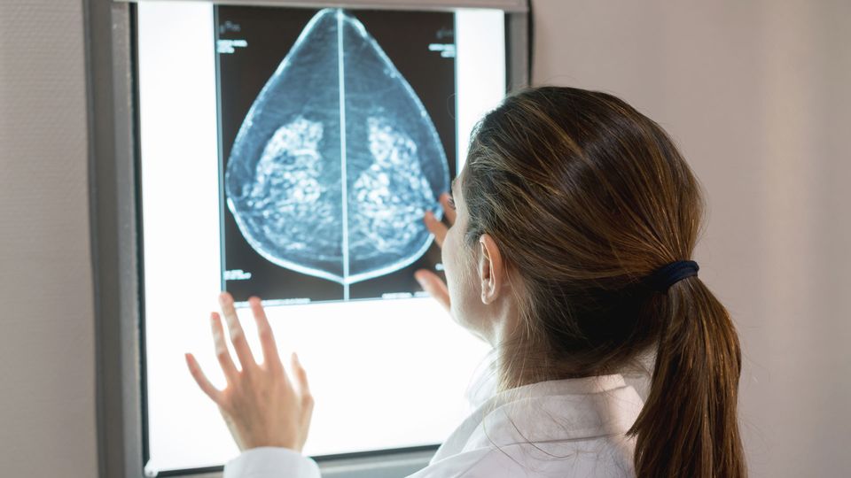 Medical professional looking a mammogram on a light board.