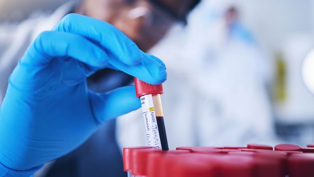 Scientist with blue gloves on putting blood tube into sample rack. 