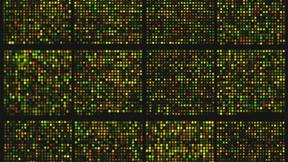 Square grids of coloured dots, mostly yellow and green. The image represents a cDNA microarray containing approximately 8,700 gene sequences.