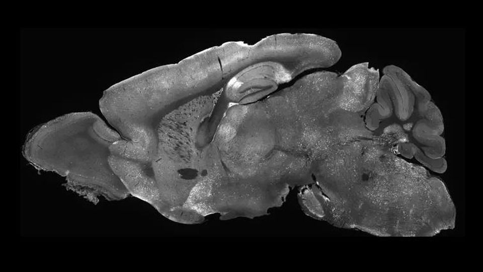 Mouse brain image glowing with experimental gene supplementation therapy highlighting how AAV delivers treatment across the entire brain 